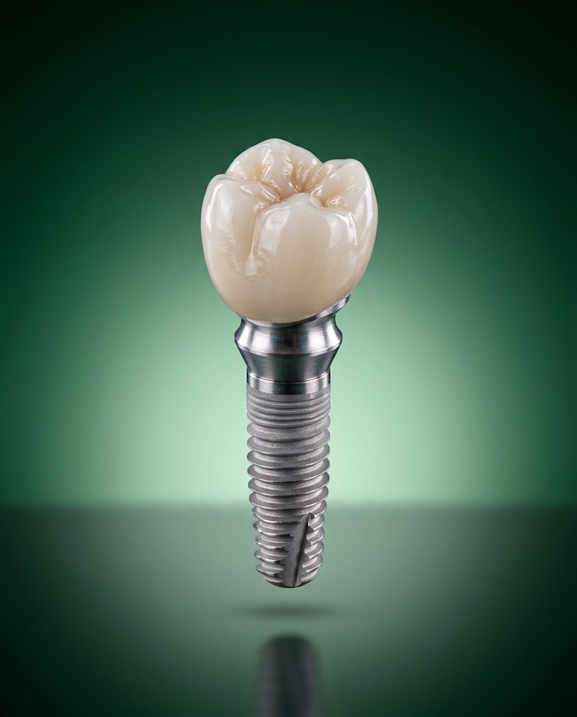 Implant crown on abutment and titanium implant